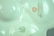 (3) PIECE LIMOGES PORCELAIN GROUP - 5