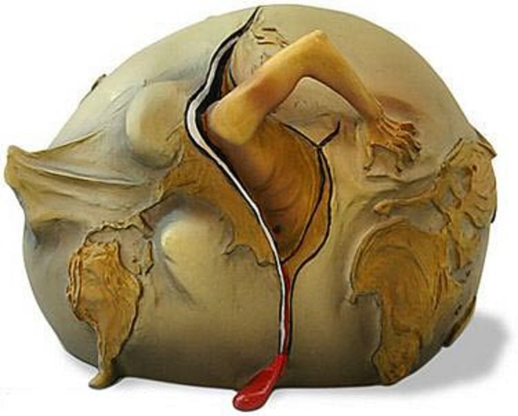 Salvador Dali GEOPOLITICAL CHILD Sculpture: This is a sculpture entitled "GEOPOLITICAL CHILD WATCHES THE BIRTH OF THE NEW HUMAN" watches the birth of the new human (1943) by Salvador Dali. This is a highly collectible, quality, resin