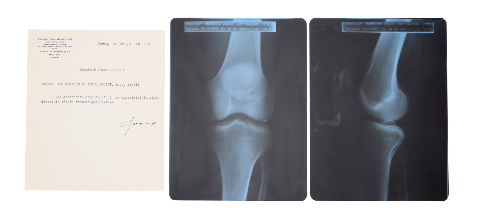 Jim Morrison | 1970 Paris Doctor's Report and Knee X-Rays (1 of 3)