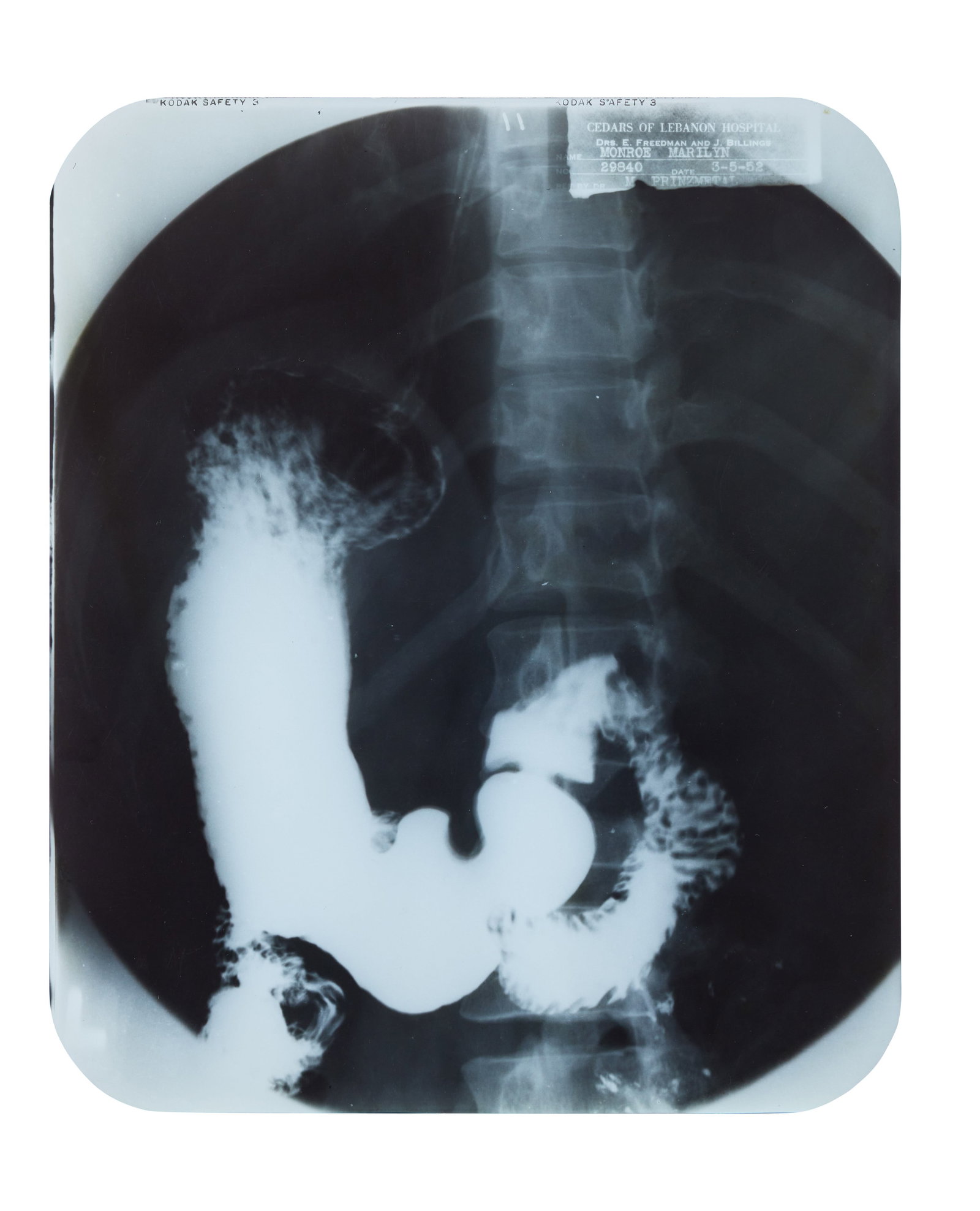 Marilyn Monroe | 1952 Gallbladder X-Ray: A standard clear plastic Kodak Safety film; with text in the upper right corner reading in part "Cedars of Lebanon Hospital / Drs. E. Freedman and J. Billings / Name Marilyn Monroe / Date 3-5-52 /