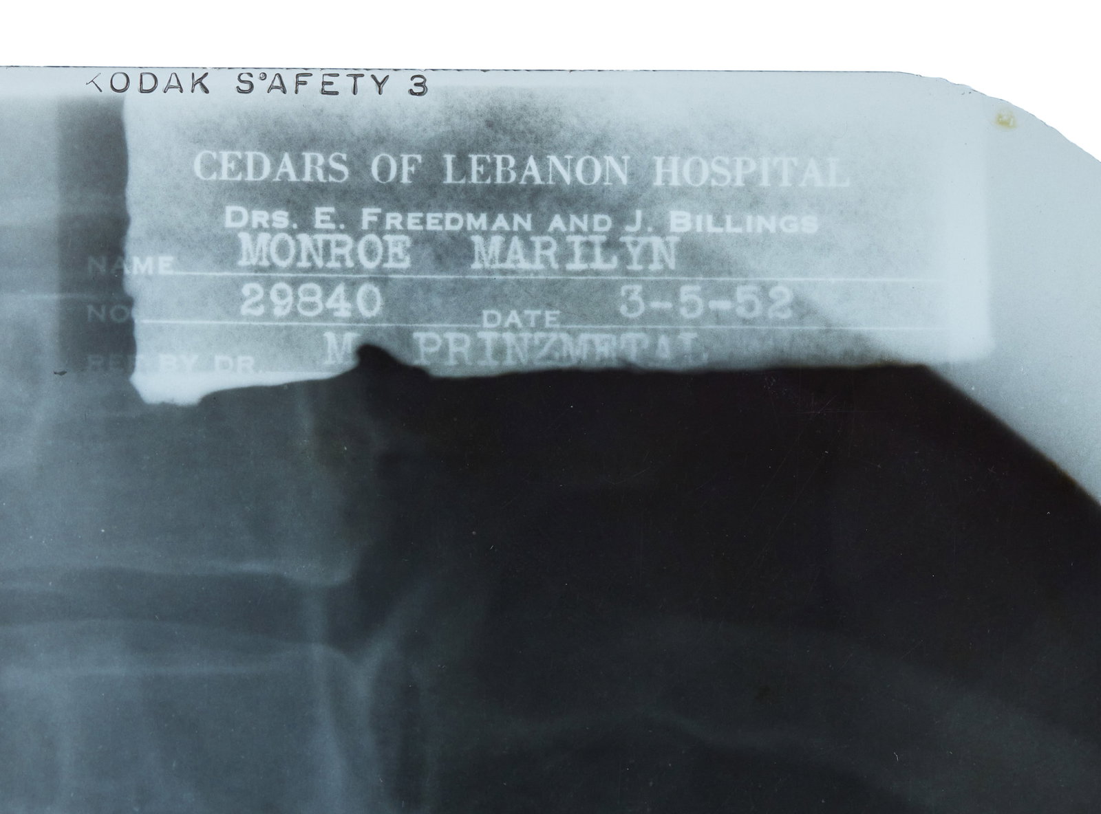 Marilyn Monroe | 1952 Gallbladder X-Ray - 2