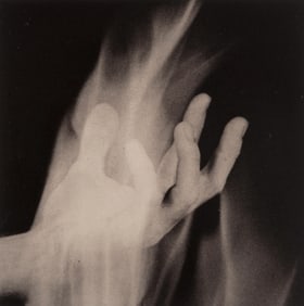 Robert Mapplethorpe, Hand in Fire, A Season in Hell, Limited Edition Photogravure