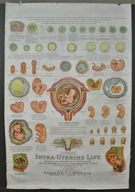 Cloth 47" Anatomy Poster G.H. Michel, Otis Lith Co.: Vintage Anatomy poster on cloth paper, Dr. Gustav H. Michel, "Intra - Uterine Life" produced by the Otis Lith Co. Cleveland. Very good condition, small series of slits in paper near top of chart over 