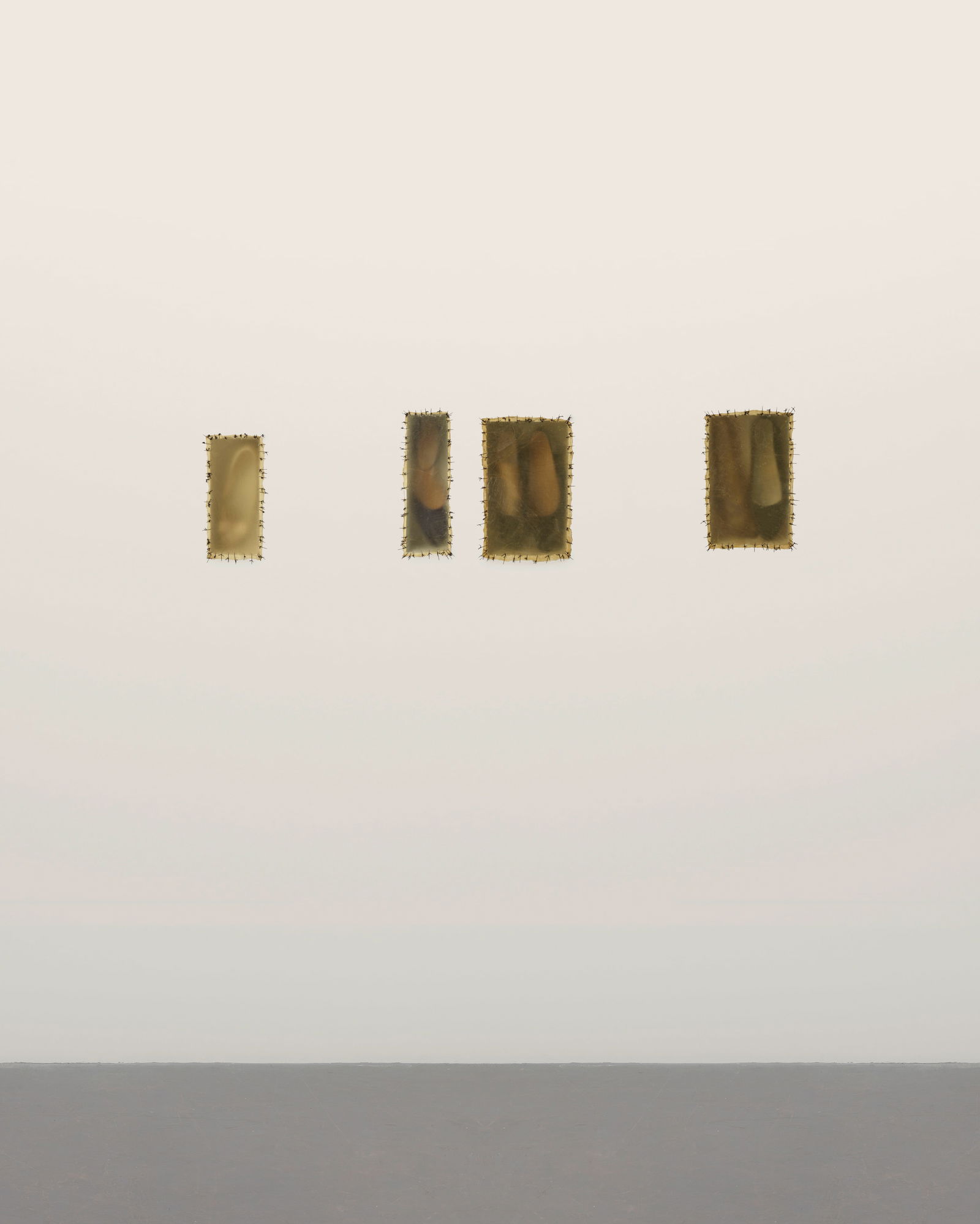 DORIS SALCEDO (B. 1950) Atrabiliarios I: 21 1/8 x 9 1/2 x 3 3/8 in (53.6 x 23.9 x 8.5 cm) II: 21...: DORIS SALCEDO (B. 1950) Atrabiliarios shoes, drywall, paint, wood, animal fiber and surgical thread I: 21 1/8 x 9 1/2 x 3 3/8 in (53.6 x 23.9 x 8.5 cm) II: 21 1/8 x 20 5/8 x 3 3/8 in (53.6 x 52.5 x 8.