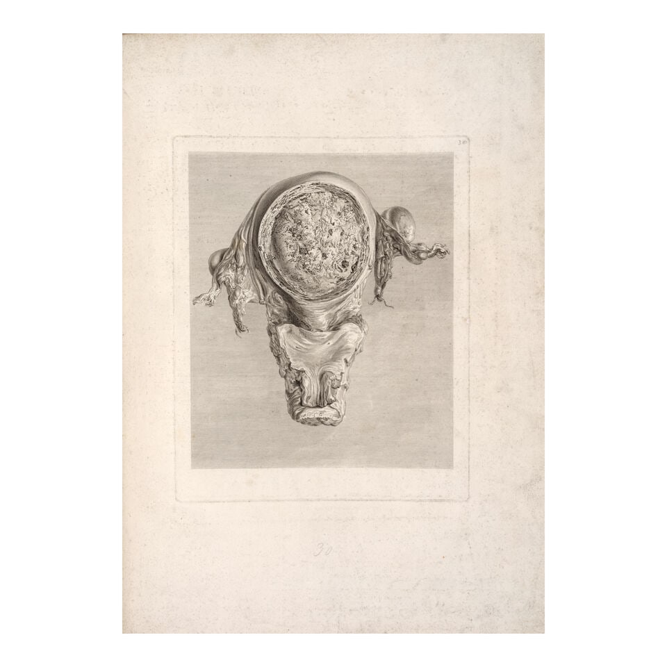 HUNTER, WILLIAM. 1718-1783. Anatomia uteri humani gravidi tabulis illustrata. The anatomy of the... - 2