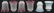 Group of 24 Glass Shades - 8