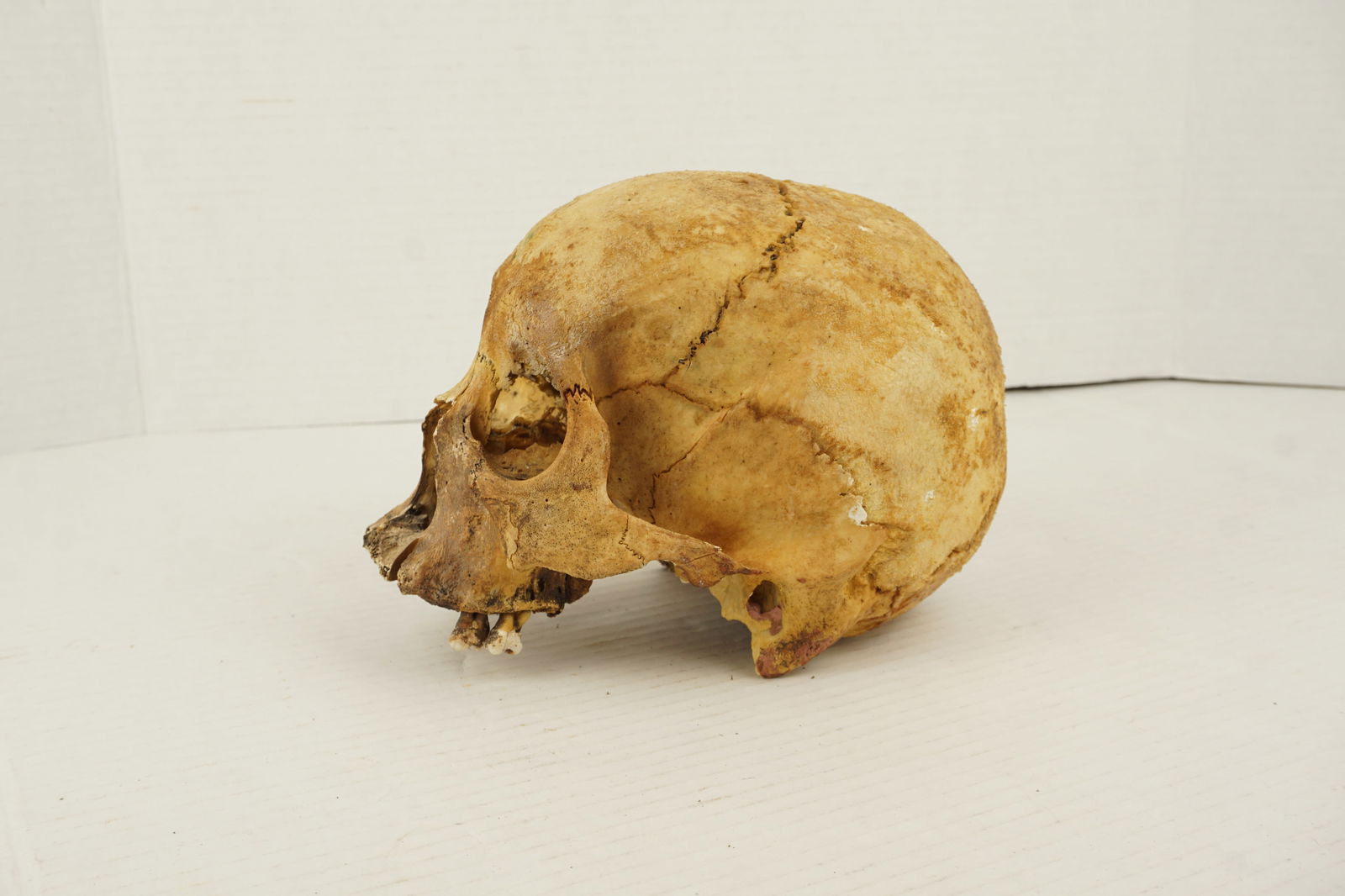Human Skull - 2