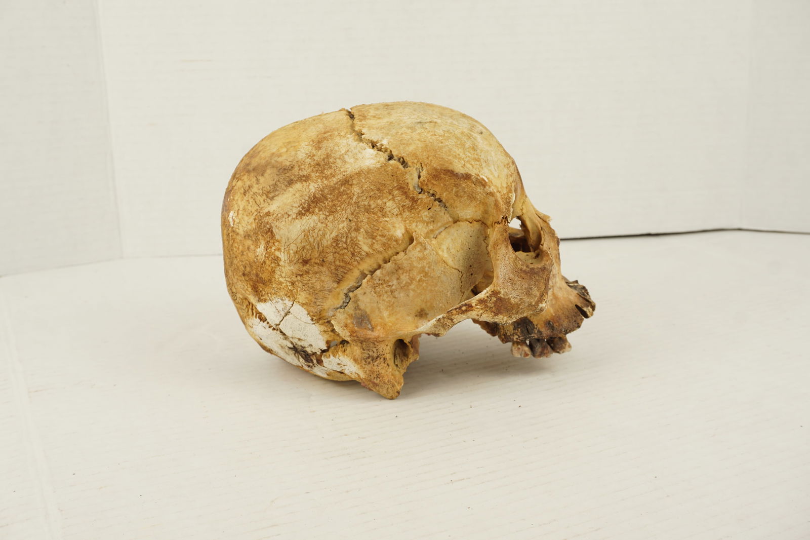 Human Skull - 4