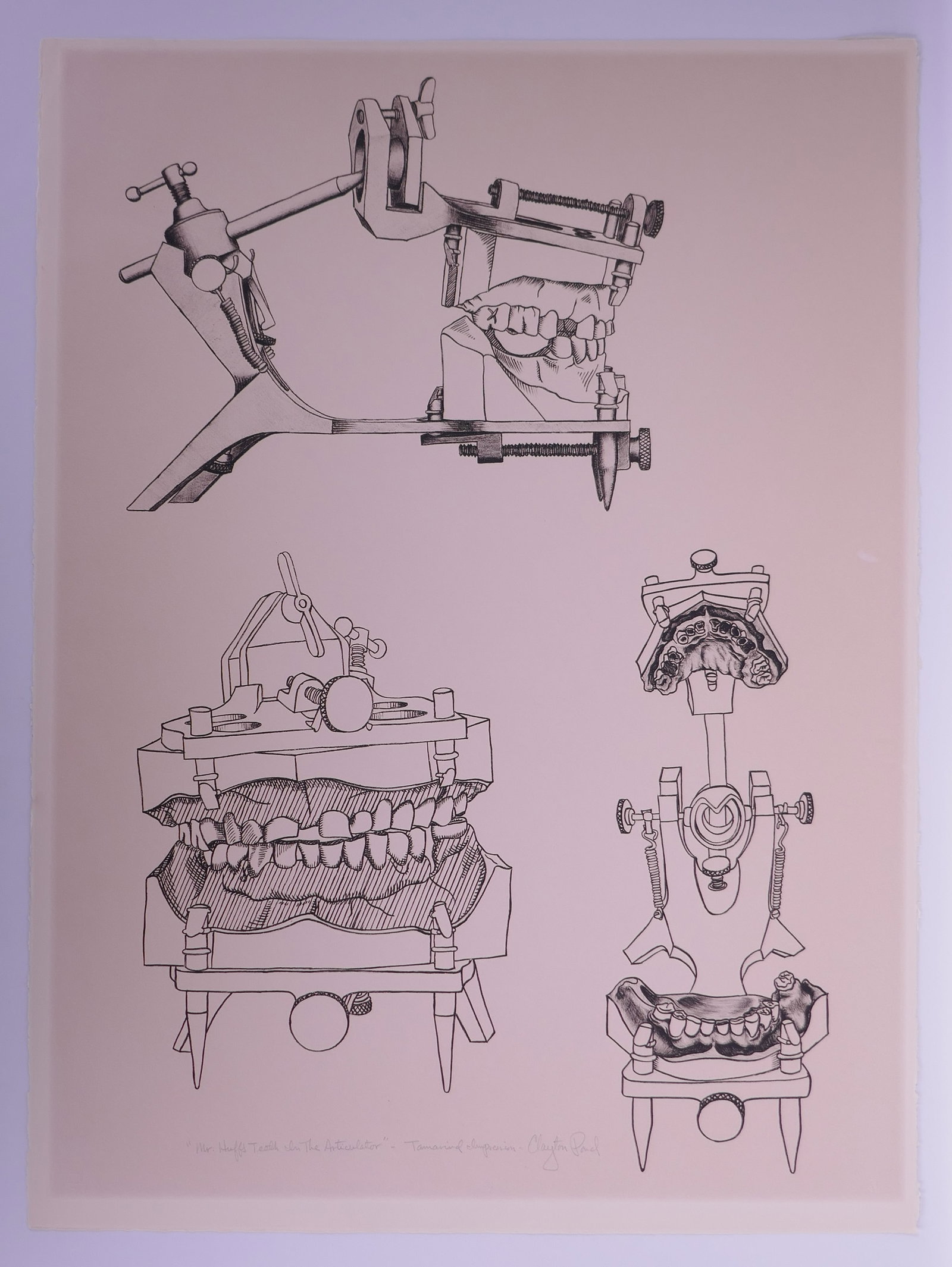 Clayton Pond (American, b. 1941), Mr. Huff’s Teeth in the Articulator, 1970 Lithograph (1 of 20)