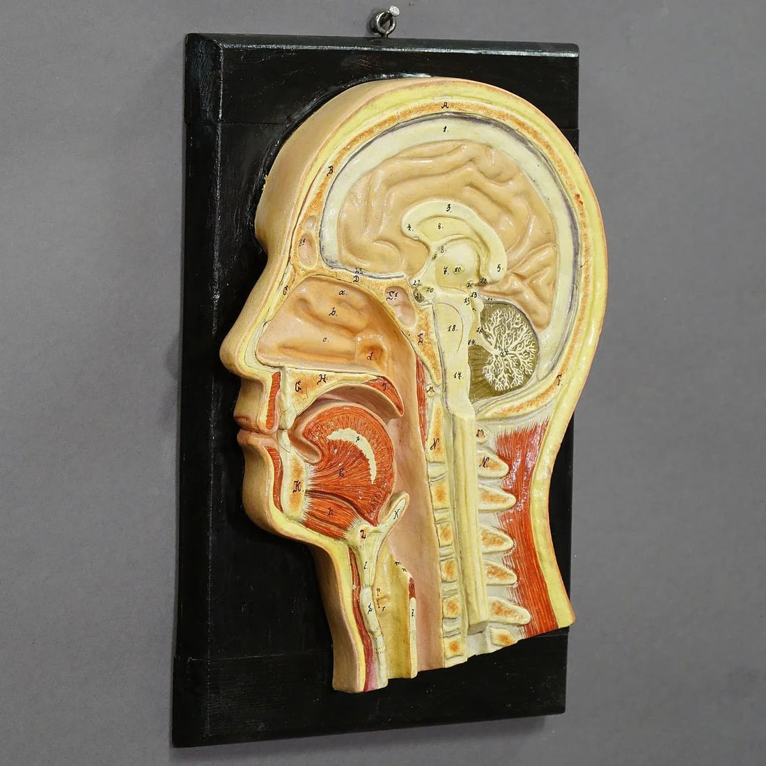 Antique Teaching Aid - Median Incision of the Human Head, Ca. 1920 - 3