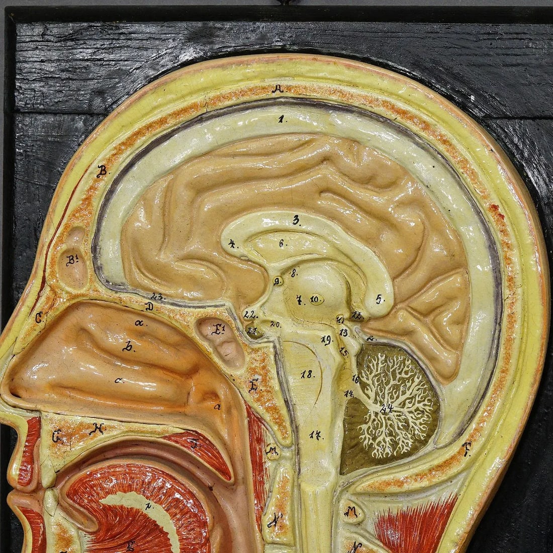 Antique Teaching Aid - Median Incision of the Human Head, Ca. 1920 - 4