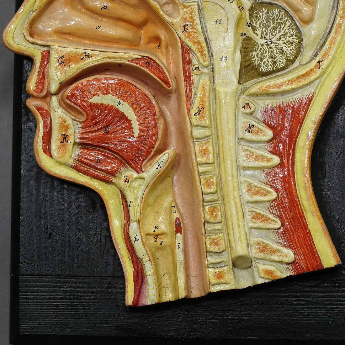 Antique Teaching Aid - Median Incision of the Human Head, Ca. 1920 - 5