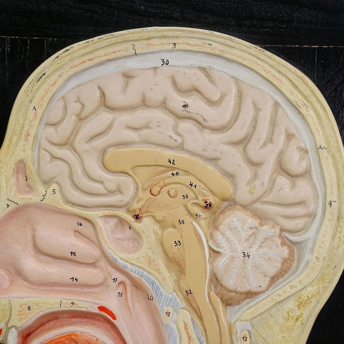 Median Incision of the Human Head Model by Phywe 1930s - 5