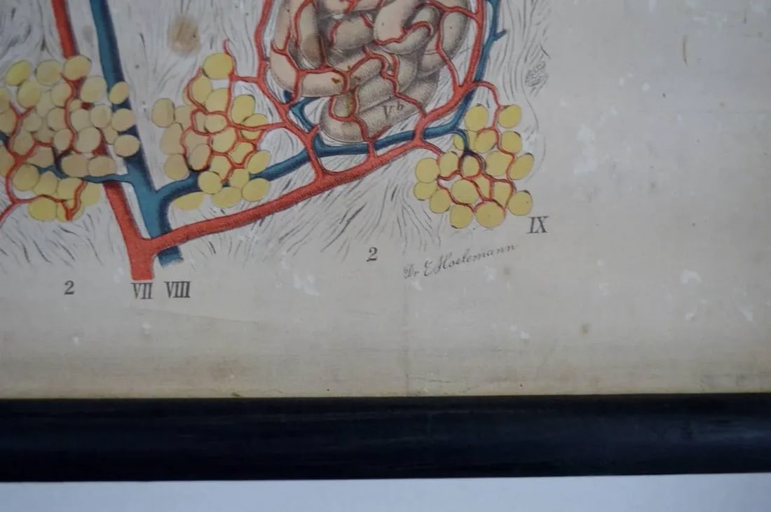 Vintage Swedish E. Hoelemann Antique Anatomical Chart - 5