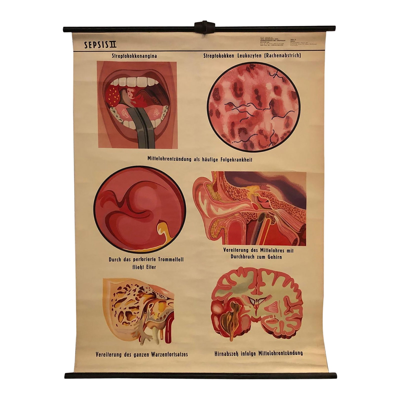 Mid 20th Century German Educational Anatomical Sepsis Study Chart (1 of 12)