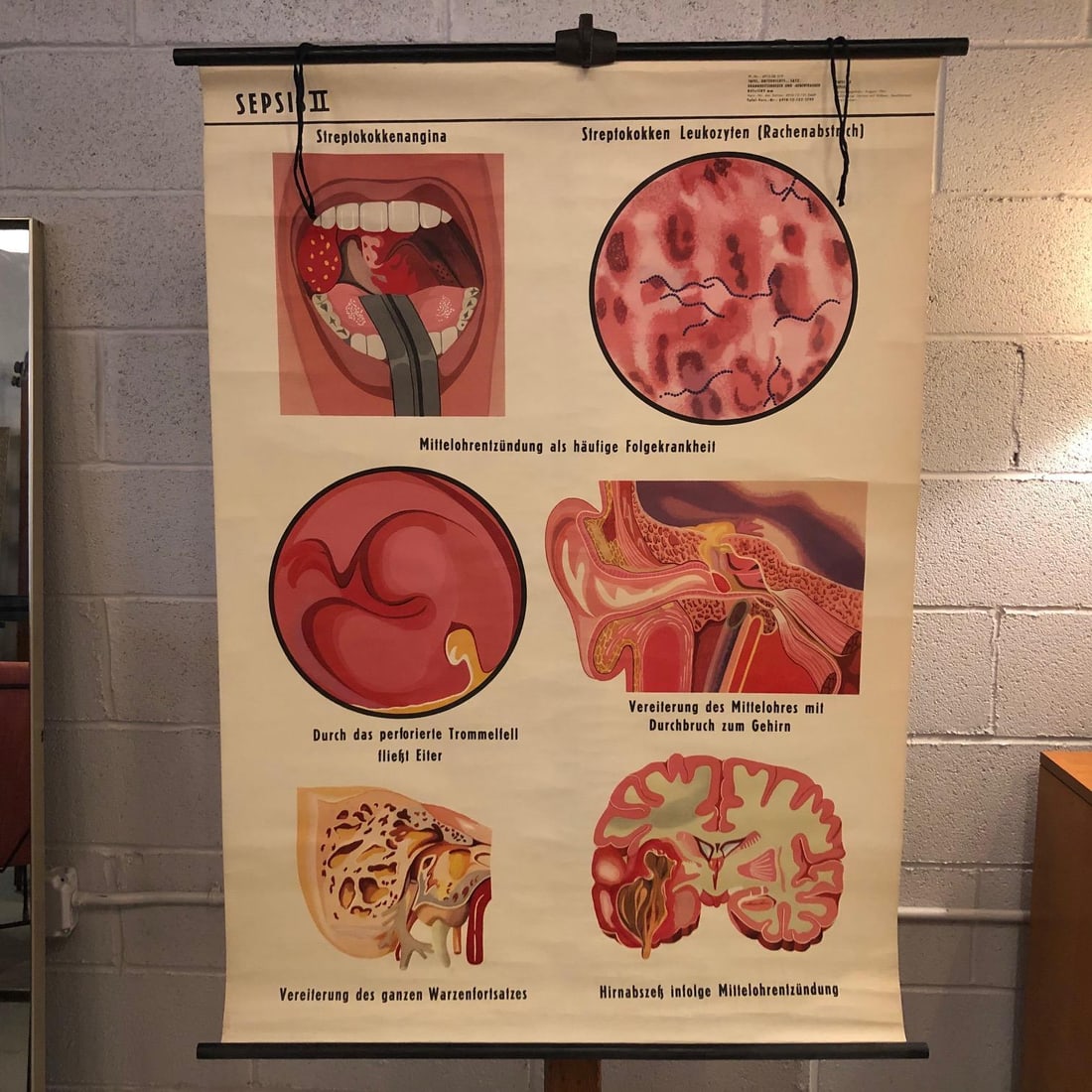 Mid 20th Century German Educational Anatomical Sepsis Study Chart - 2