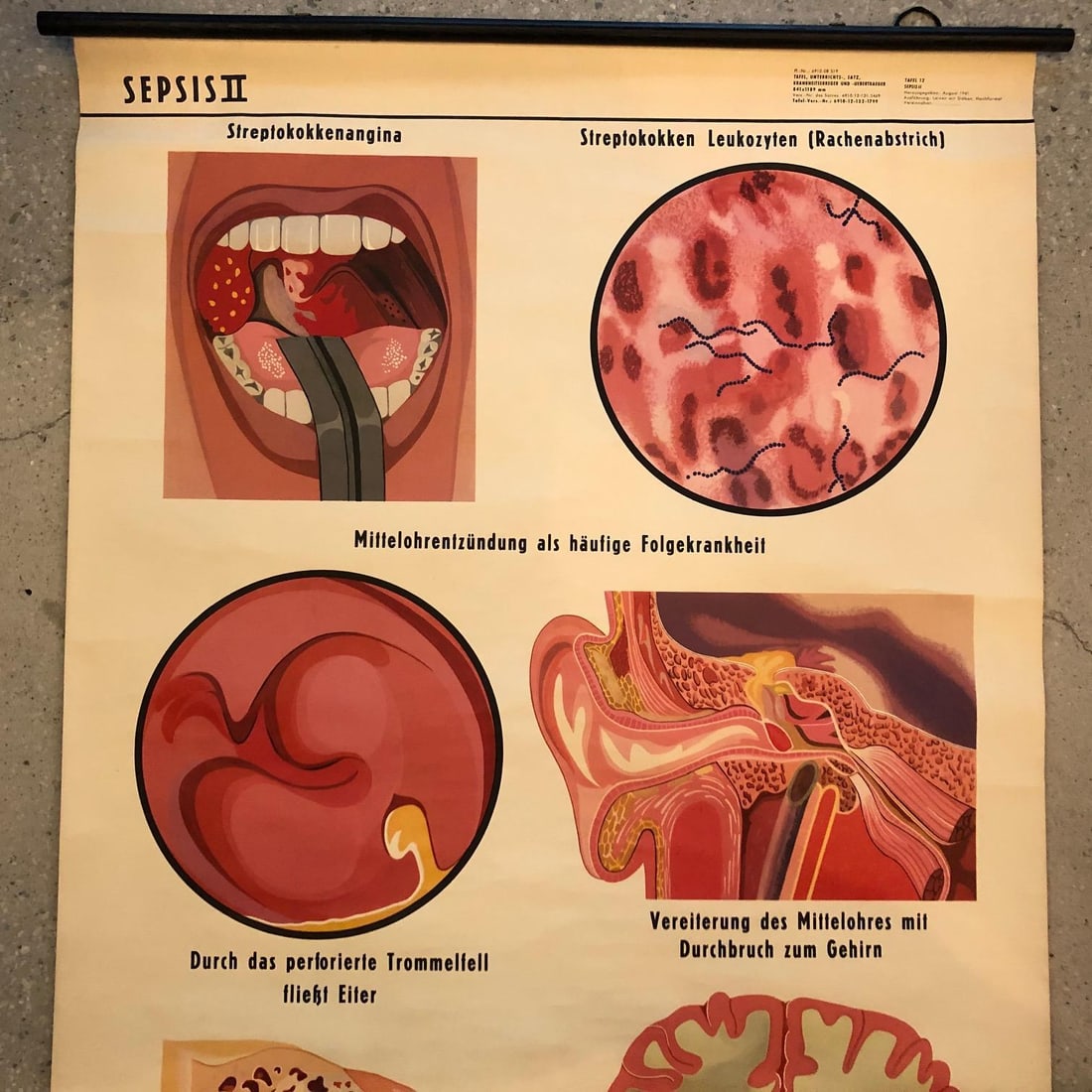 Mid 20th Century German Educational Anatomical Sepsis Study Chart - 3