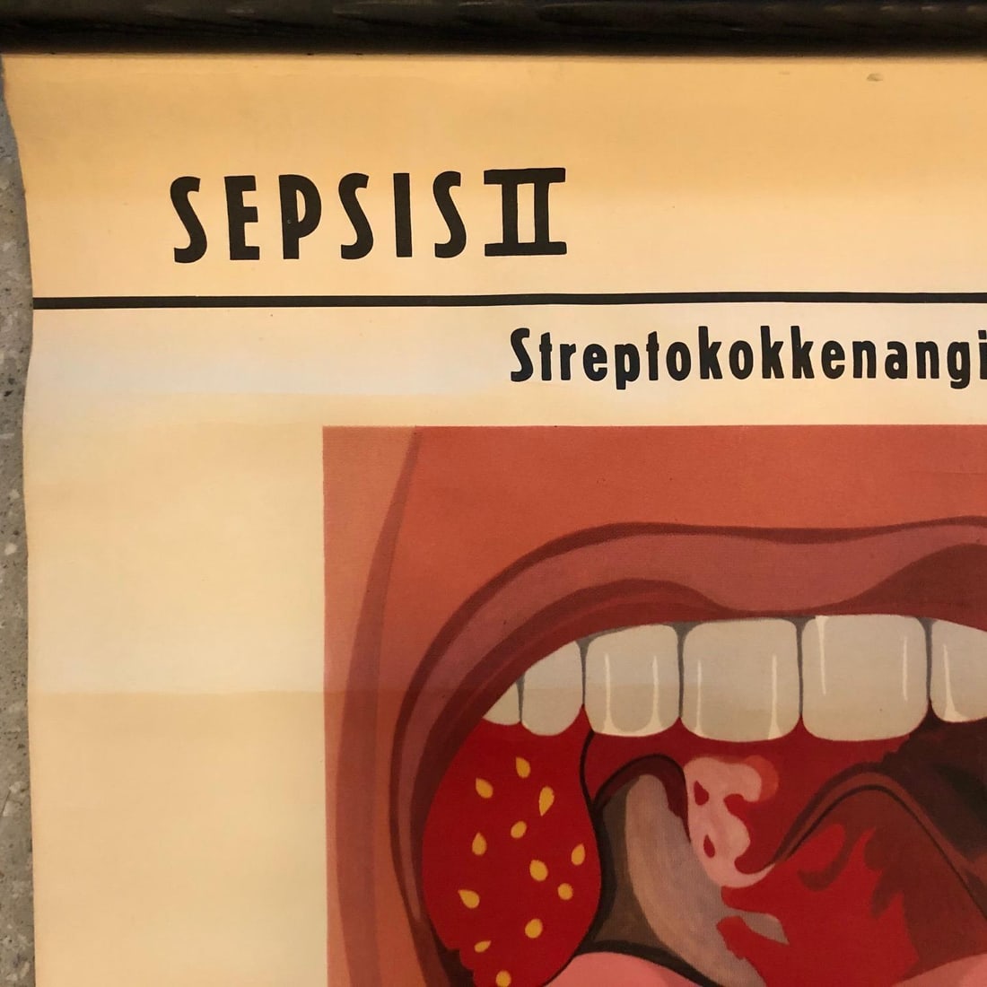 Mid 20th Century German Educational Anatomical Sepsis Study Chart - 4
