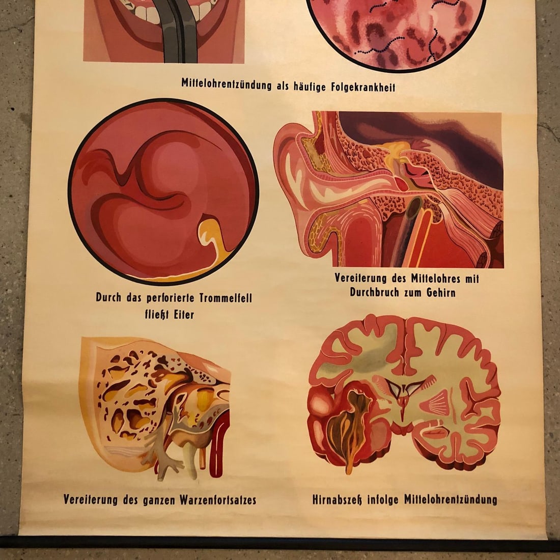 Mid 20th Century German Educational Anatomical Sepsis Study Chart - 5