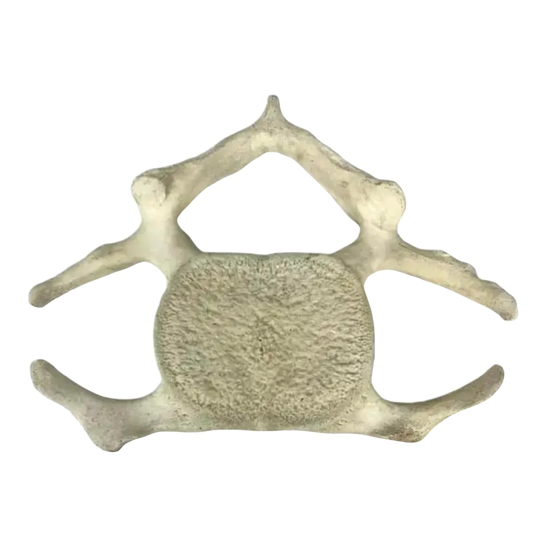 Fossilized Whale Vertebrae: Natural weathered fossilized Whale Vertebrae. One section / specimen. Possibly sperm whale. Likely 19th century. Condition: Alterations: Original Condition Unaltered Imperfections: Some Imperfections 