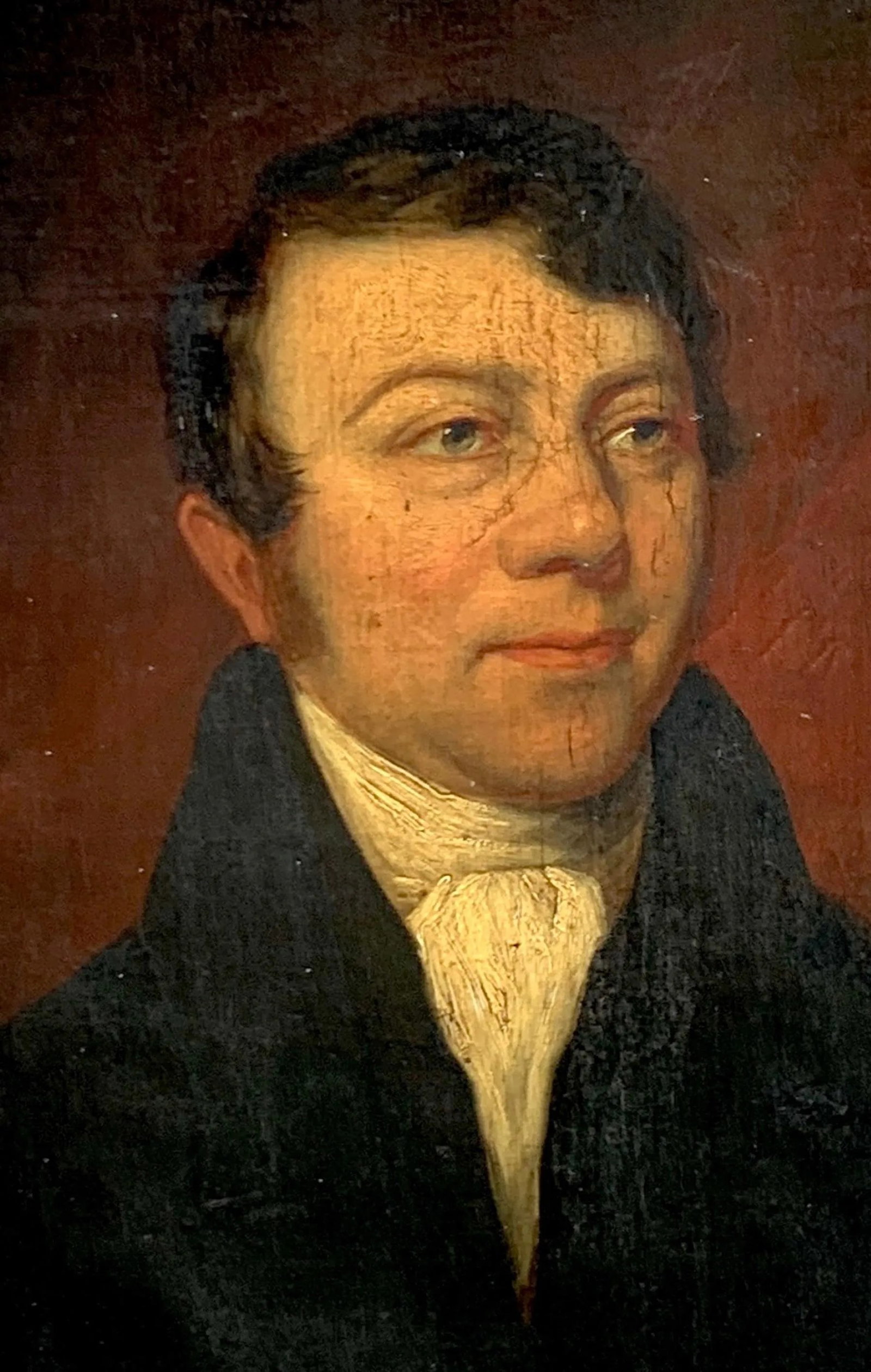 Handsome 19th C American Portrait of a Gentleman with a Scar - 3