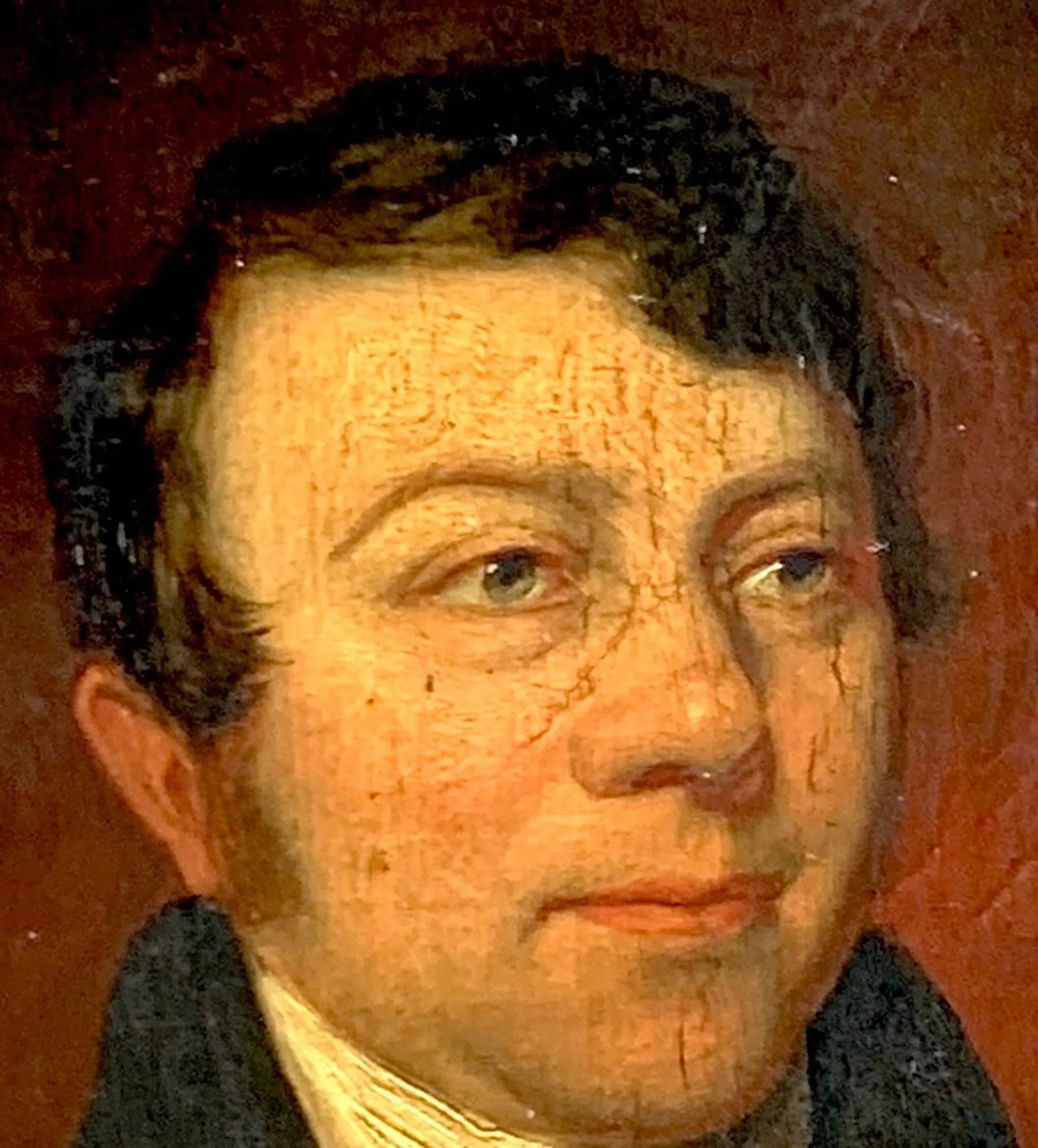 Handsome 19th C American Portrait of a Gentleman with a Scar - 4