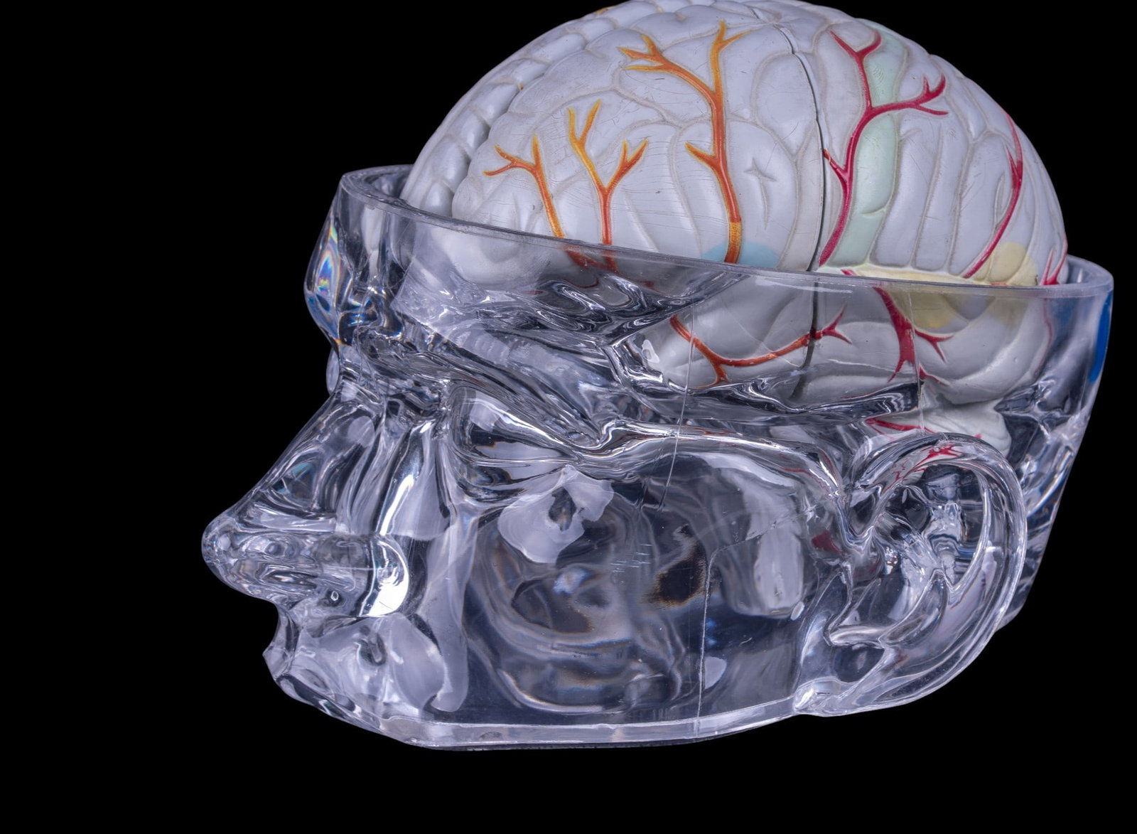 Seroquel Advertising Brain Display Model - 3