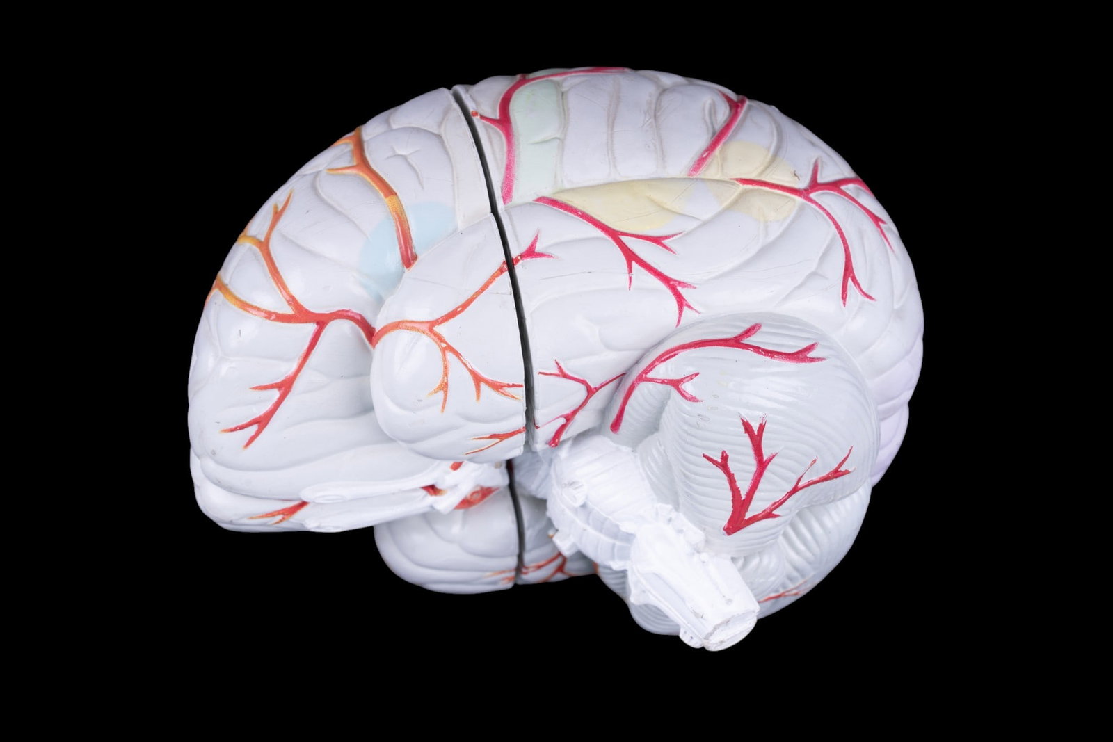 Seroquel Advertising Brain Display Model - 4