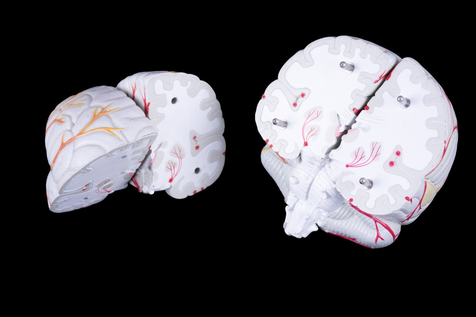 Seroquel Advertising Brain Display Model - 5