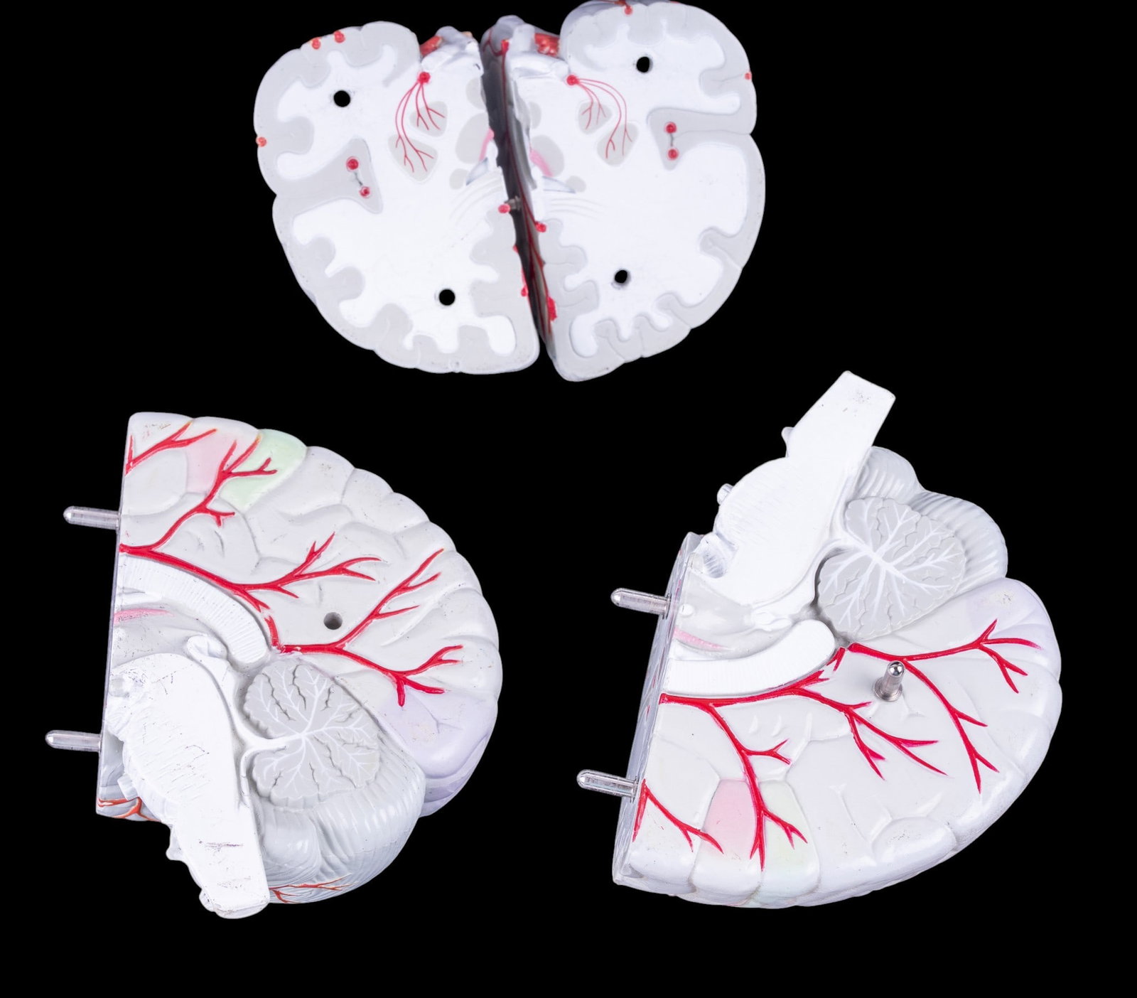 Seroquel Advertising Brain Display Model - 6