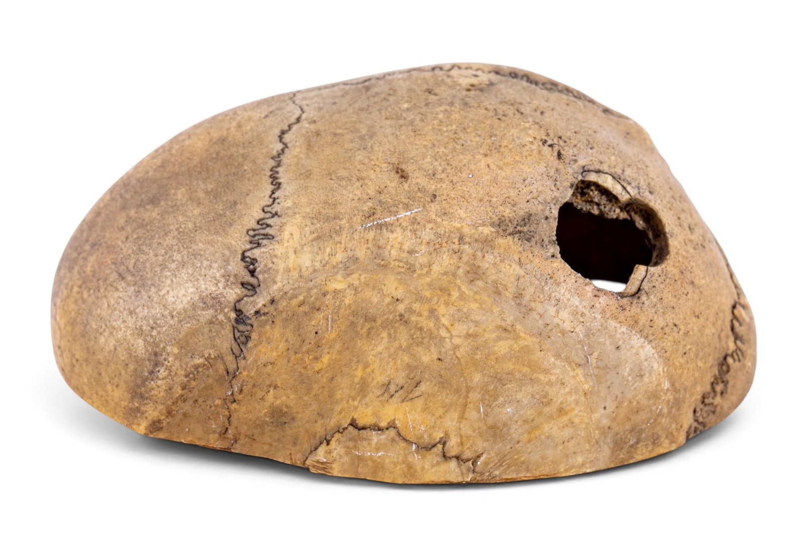 19th C Medical Cranium Specimen (1 of 10)