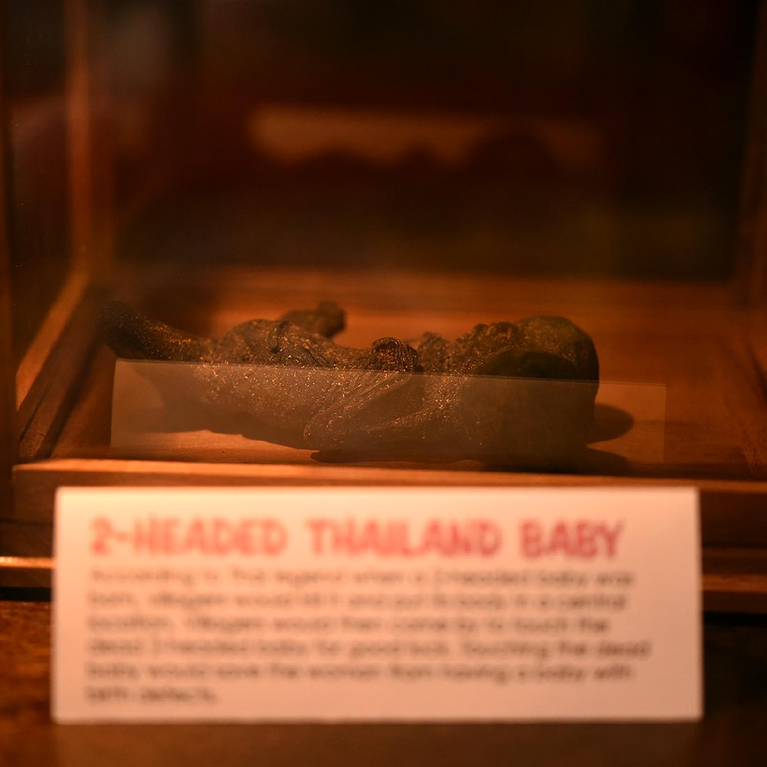 Two Headed Thailand Baby (1 of 1)