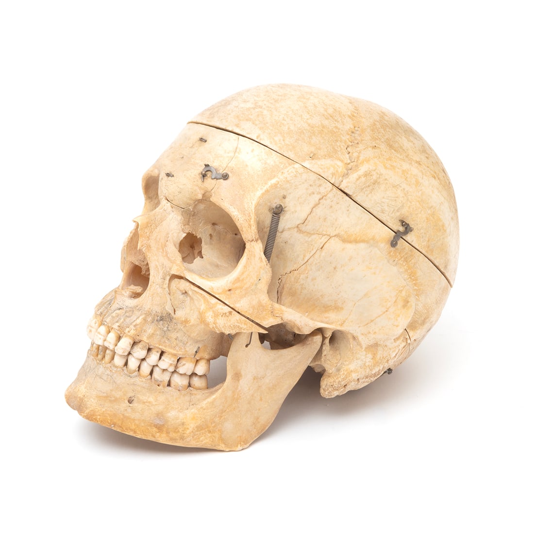 Medical Human Skull. (1 of 4)