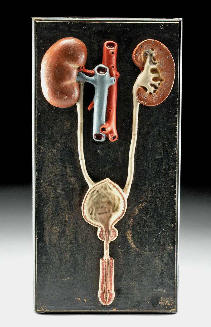 Early 20th C. European Wood & Plaster Medical Model (1 of 3)