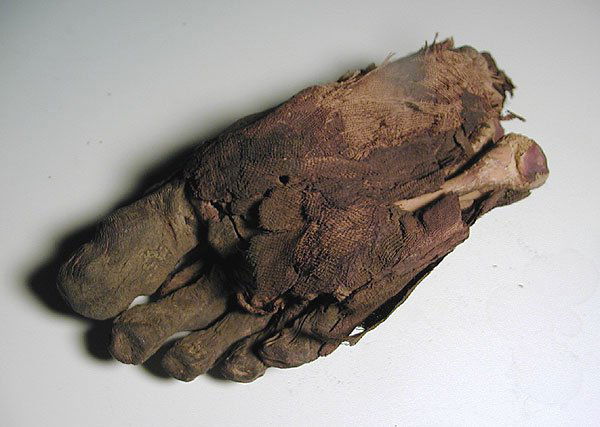 A Very Rare Egyptian Mummified Foot - 6