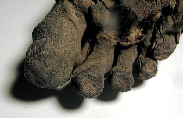 A Very Rare Egyptian Mummified Foot - 7