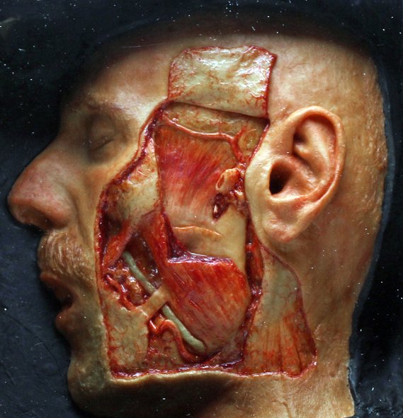 Late 19th C. German Wax Dissected Model, ex-Historia (1 of 2)