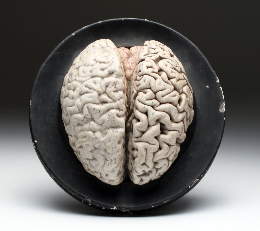 19th C. German Anatomical Brain Model, ex-Historia (1 of 2)
