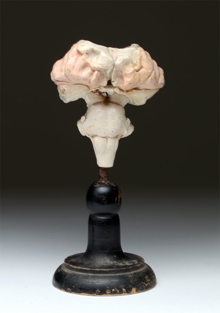 19th C. French Plaster Model of Brain Stem and Medulla (1 of 4)
