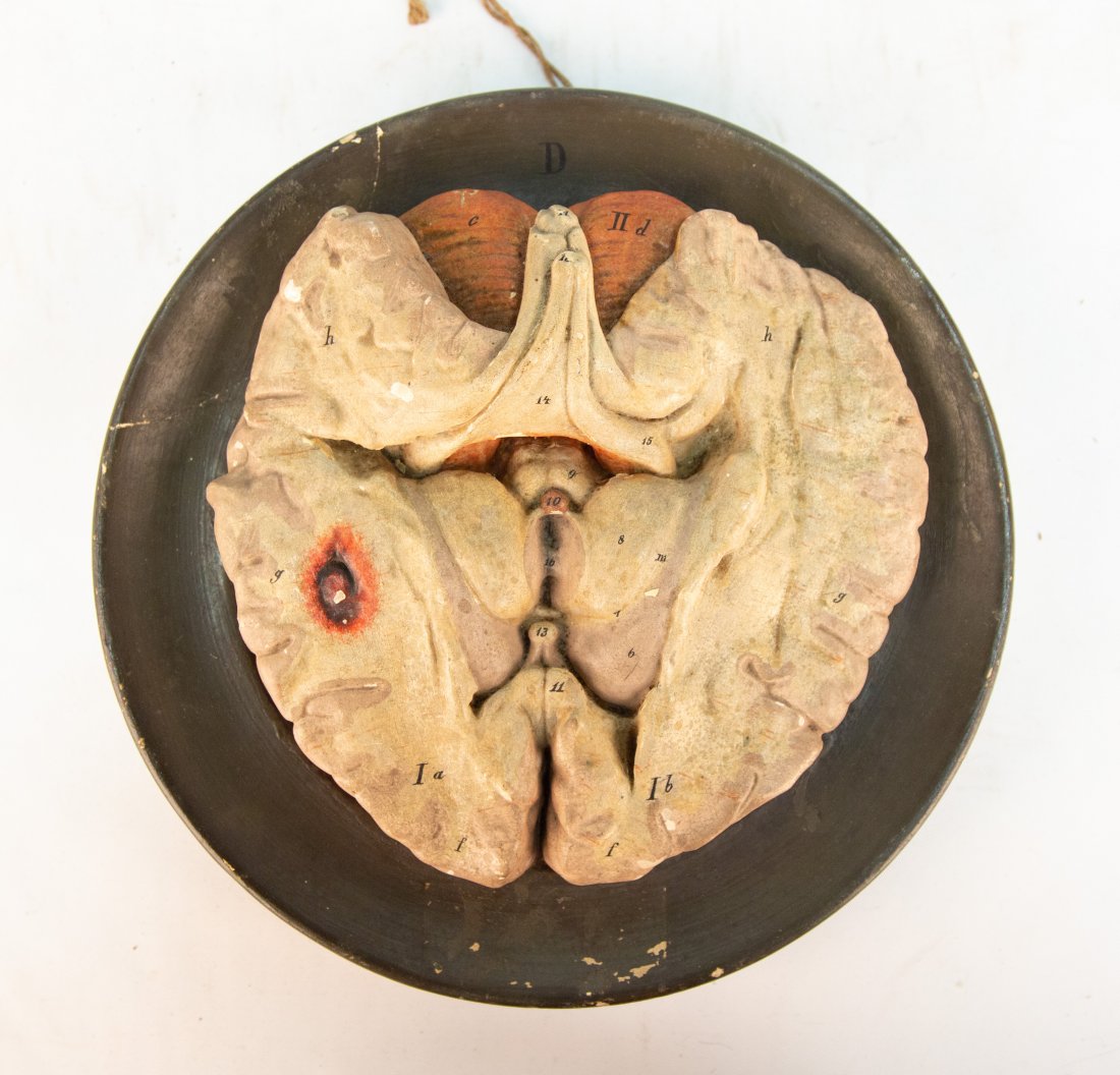 Vintage Ceramic Medical Model (1 of 2)