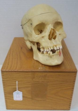 Oak Wooden Library Box with Dentist Practice Skull:: Oak Wooden Library Box with Dentist Practice Skull: Doctors have Cadavers and I Guess Dentists have Wayne. Scientific Thing Used for Fledgling Dentist to get Their Chairside Manor and Skills Down. Dat