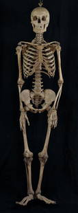 Antique human medical skeleton: Real human skeleton, not a plastic copy. This is an antique pieces dating to the early 20th Century. Most likely male. assembled with steel wire, bolts and brass thumbscrews. appears to be complete, j