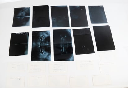 Extensive Collection of JFK Jr. Dental X-Rays