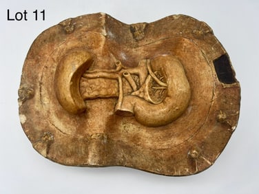 Vintage Plaster Anatomical Model of Pancreas