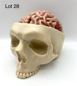 GPI Brain Pathology Model