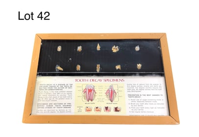 Vintage Spenco Tooth Decay Display Model w/ Real Teeth