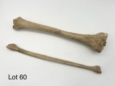 Antique Authentic Human Bone Tibia and Fibula Set