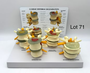 3B Scientific 4-Stage Vertebrae Anatomy Model