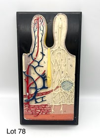 Vintage Plaster Intestinal Villi Anatomical Model