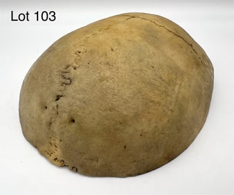 Antique Authentic Human Calvarium